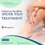 Spider Vein Treatment in NJ