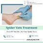 Advanced Spider Vein Treatment in NJ