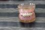 Revitalize Your Smile with Dentures in Hampton, VA