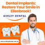 Dental Implants: Restore Your Smile in Ellenbrook!