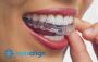 Get a Dental Invisalign Treatment with Emergency Dentist