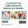 Transform Your Smile with Dental Implants in Columbia