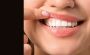 Illuminate Your Confidence: Teeth Whitening Solutions