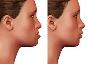 Expert Corrective Jaw Surgery Solutions in Chelsea