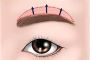 Eyebrow Lift Surgery In Lucknow
