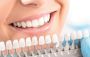 Best Teeth Whitening Service Doctors in Ahmedabad | 98251585