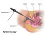 Hysteroscopy in Mumbai: Quality Care, Affordable Cost
