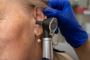 Which is Better: Ear Syringing or Microsuction for Earwax Re