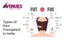 Types of Hair Transplant in India