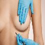 Expert Breast Surgeon in Pune | Cosmetic Surgery Pune