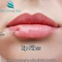 Lip Fillers Chicago Injections 