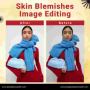 Professional Removal Skin Blemishes Image Editing Company