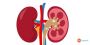 Kidney Dialysis Treatment in India