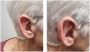 Affordable Private Hearing Aids in Leamington Spa
