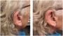 Private Hearing Aids in Stratford-upon-Avon