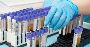 Find out about the best biobank in India