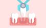 Kamal Dental Clinic - Best Dentists For Tooth Extraction