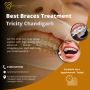 Uncover Your Best Smile with Lifecare Dental's Braces Treatm