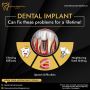 Dental Implants in Chandigarh | Lifecare Dental 