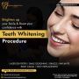 Teeth Whitening in Chandigarh | 15-20% Save - LifecareDental