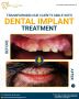 Dental Implants in Chandigarh | Lifecare Dental Clinic
