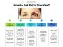 Freckle Removal Treatment in Singapore | Lim Clinic Freckle Removal Treatment in Singapore | Lim Clinic