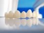 Mastering Zirconia Crowns: Your Ultimate Guide