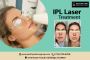 Your Skin's Solution with IPL Laser Treatment in NJ