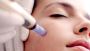 Experience Micro Needling Excellence in Kolkata