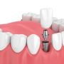 Smiles On 35th: The Best Dentistry in Wedgwood