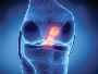 Knee Ligament Treatment in Delhi