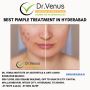 Best pimple treatment in Hyderabad