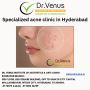 Specialized acne clinic in Hyderabad