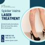 Laser Treatment For Spider Veins NJ