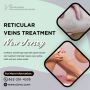 Reticular Veins Treatment NJ Reticular Veins Treatment NJ