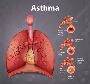 Asthma: Insights from Dr. Virendra Singh