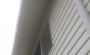 Few Signs That Indicate When to Have Your Fascia Repair in V Few Signs That Indicate When to Have Your Fascia Repair in V