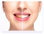 Copley, Natural Teeth Whitener