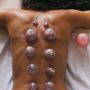 Dry Cupping Therapy in Ghaziabad and Indirapuram