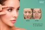 Eyelid Surgery In Whitefield, Bangalore At Anew