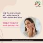 Revolutionize Your Skin: ARV Aesthetics Acne Treatment Solut