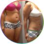 Finest Liposuction Surgery Clinic In Nagpur