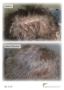 Excellent Hair Loss Treatment to Contribute to Your Public I