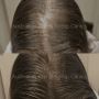 Regrow Your Hair: Experience Natural Hair Treatment in Sydne