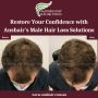 Restore Your Confidence with Aushair's Male Hair Loss Soluti