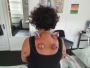 Top Cupping Therapy for Shoulder Pain in Derby