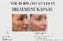 Enhance Natural Beauty with Micropigmentation Treatment in K