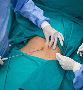 Body Contouring Surgery Clinic in Ahmedabad