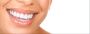 Find the Best Dentist in California | Professional Dentistry