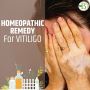 Homeopathic treatment for white spots on skin